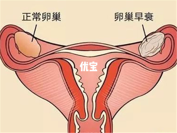 卵巢组织冷冻全球有200多例