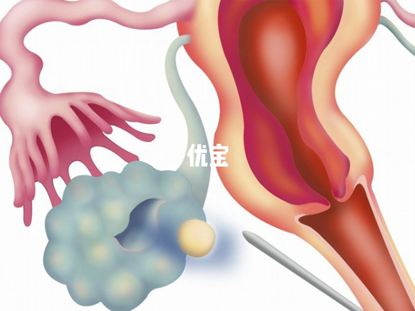 取卵后首先应该卧床休息