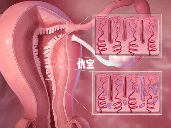 做試管月經期間的檢查專案