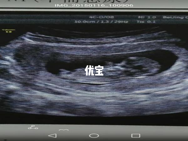 B超檢查可以推算出生日期
