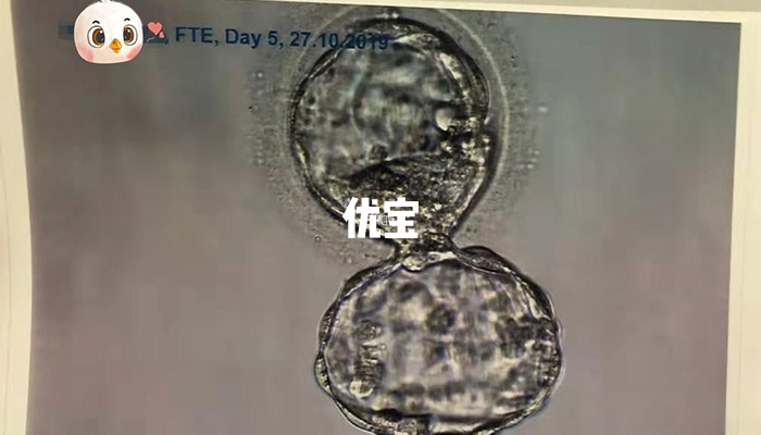 胚胎冷冻了14年不建议移植了