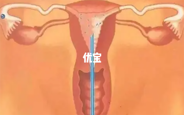 b型内膜移植的成功率较高