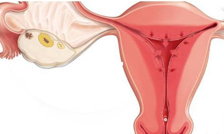 C型的子宫内膜不容易着床