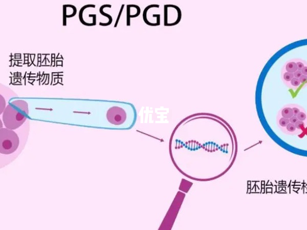 遗传学筛查费用较高