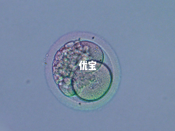 融合胚胎和囊胚的区别比较大