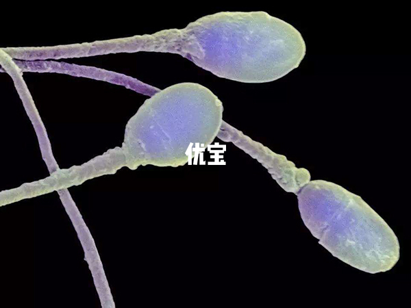 精子活力對試管嬰兒的影響大