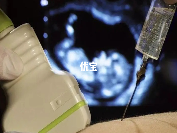 重庆多家医院能做羊水穿刺